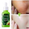 Avocado Complete 30 Times Vitamin C Nicotinamide Enhanced Essence Facial Repair Essence Acne Removing Beauty Product Face Care