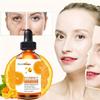 Vitamin C Serum Nourishing Skin Face Serum, Face Dark Spots Freckles Removal Anti-wrinkle Serum Face Care