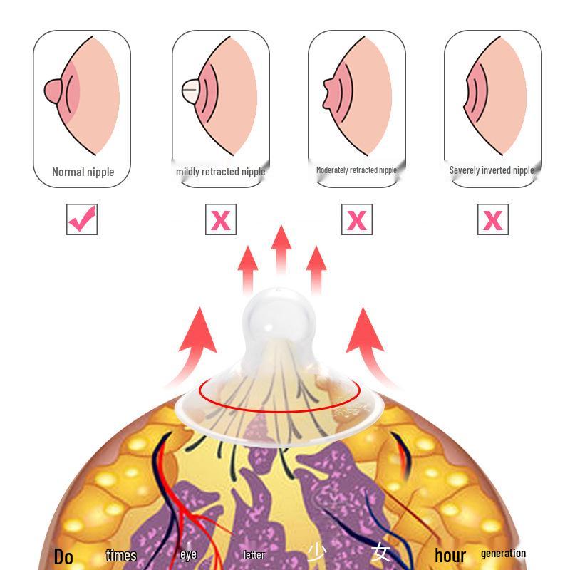 Nipple Corrector for Breastfeeding: Inverted, Short, Small, Flat Nipple Correction and Postpartum Recovery