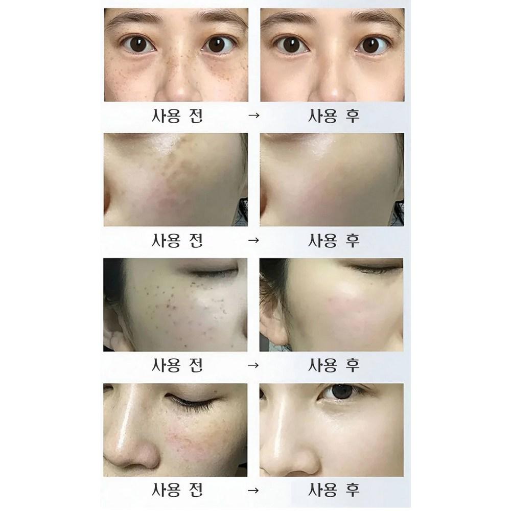 Collagen Luxury Sebum Soaking Gold Peel Off Pack Pore Shrinking Whitening Spot Care Wrinkle Improvement, 100mlx1