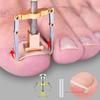 Ingrown Toenail Corrector - 1pc, Softens & Trims Easily, Pedicure Nail Recovery Patch, Odorless Foot Care