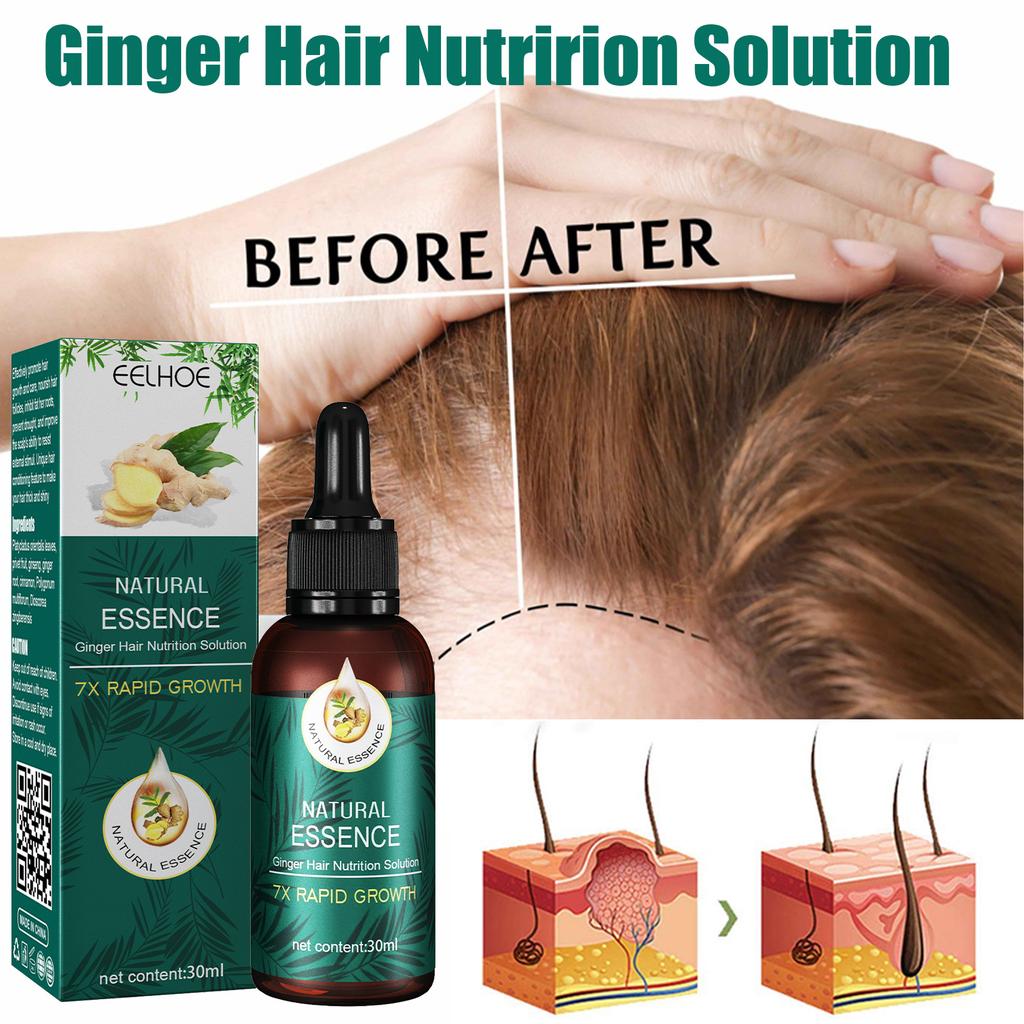 30ml Hair Essence Long Lifespan Universal Unique Practical Ginger Hair Nutrition Solution Essence for Unisex