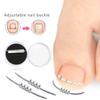 Ingrown Toenail Corrector Tools Pedicure Recover Embed Toe Nail Treatment Professional Ingrown Toenail Correction Foot Caretool