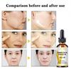 5ML/15ML/30ML/50ML/Refining Serum Shrink Pores Tightens Skin Care Essence Moisturizing Whitening Control Oil Facial Essence Anti-aging